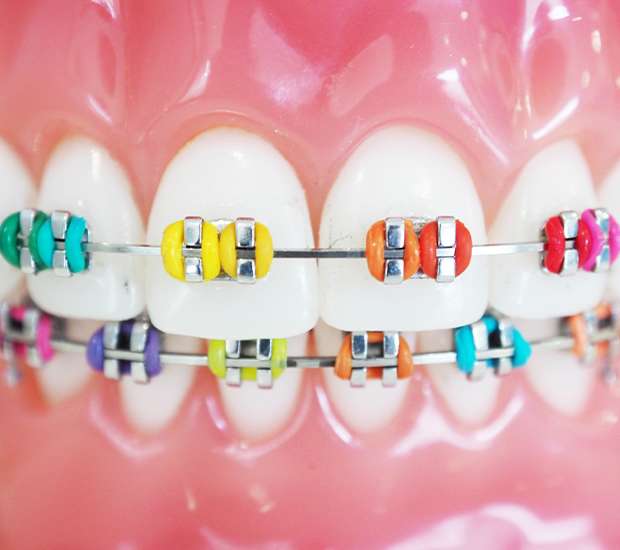 Cameron Orthodontist