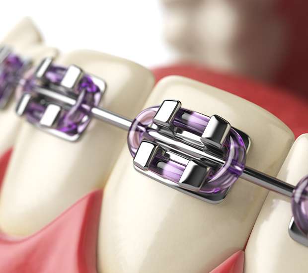 Cameron Orthodontist